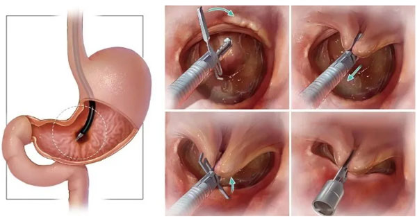 tts-tc-an-innovation-with-courage-and-persistence4.jpg tts-tc-an-innovation-with-courage-and-persistence4.jpg